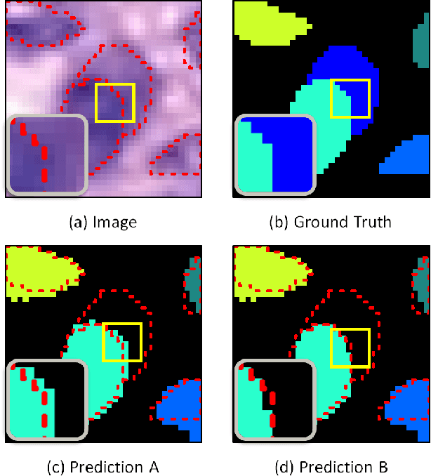 Figure 4 for XY Network for Nuclear Segmentation in Multi-Tissue Histology Images