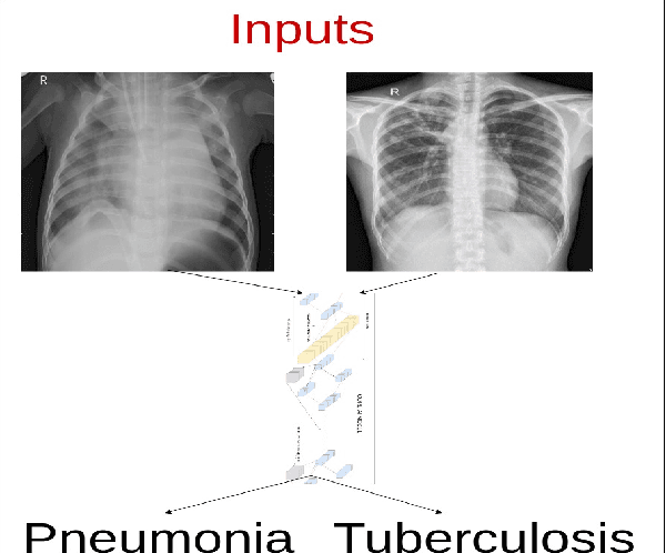 Figure 1 for Towards Radiologist-Level Accurate Deep Learning System for Pulmonary Screening