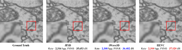 Figure 4 for iWave3D: End-to-end Brain Image Compression with Trainable 3-D Wavelet Transform