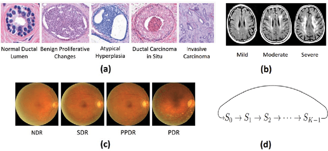 Figure 1 for Leveraging Disease Progression Learning for Medical Image Recognition