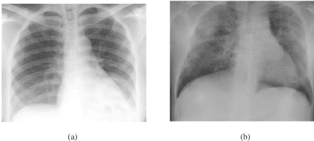 Figure 4 for A Deep Learning Approach for the Detection of COVID-19 from Chest X-Ray Images using Convolutional Neural Networks