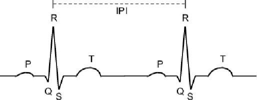 Figure 2 for Information Theoretic Key Agreement Protocol based on ECG signals