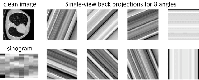 Figure 2 for Unsupervised Sparse-view Backprojection via Convolutional and Spatial Transformer Networks