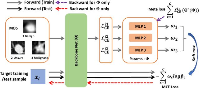 Figure 1 for Meta ordinal weighting net for improving lung nodule classification