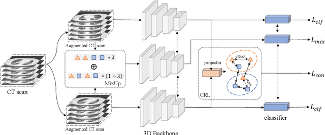 Figure 1 for FDVTS's Solution for 2nd COV19D Competition on COVID-19 Detection and Severity Analysis