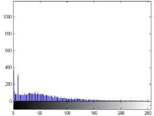 Figure 4 for Segmentation of ultrasound images of thyroid nodule for assisting fine needle aspiration cytology