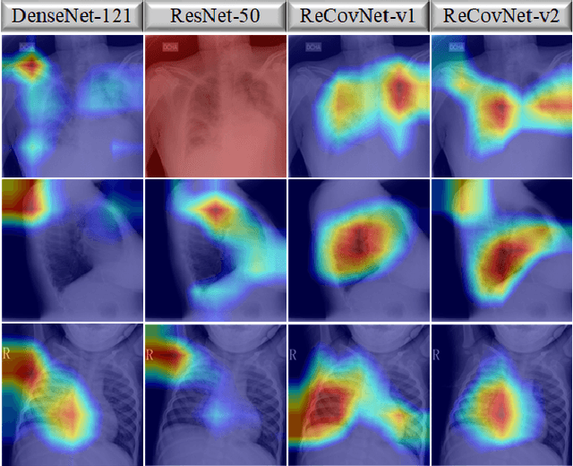 Figure 4 for Reliable COVID-19 Detection Using Chest X-ray Images