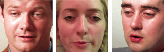 Figure 3 for DIF : Dataset of Intoxicated Faces for Drunk Person Identification