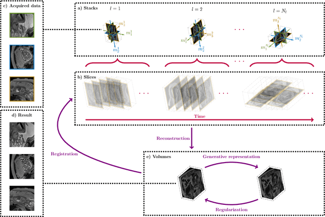 Figure 1 for Fetal MRI by robust deep generative prior reconstruction and diffeomorphic registration: application to gestational age prediction