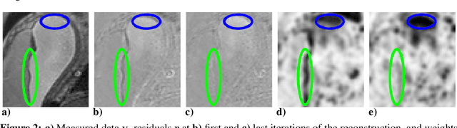 Figure 3 for Fetal MRI by robust deep generative prior reconstruction and diffeomorphic registration: application to gestational age prediction