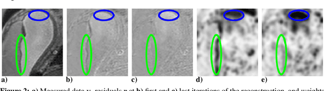 Figure 3 for Fetal MRI by robust deep generative prior reconstruction and diffeomorphic registration: application to gestational age prediction