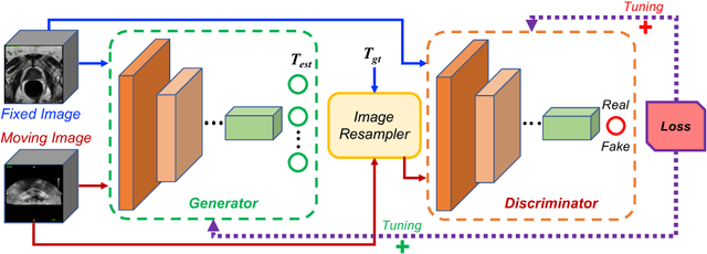 Figure 1 for Adversarial Image Registration with Application for MR and TRUS Image Fusion