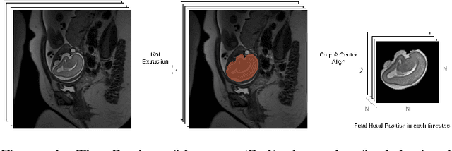 Figure 1 for Deep Predictive Motion Tracking in Magnetic Resonance Imaging: Application to Fetal Imaging