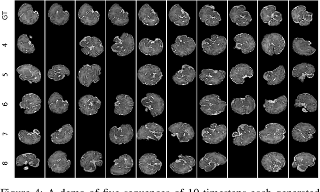 Figure 4 for Deep Predictive Motion Tracking in Magnetic Resonance Imaging: Application to Fetal Imaging
