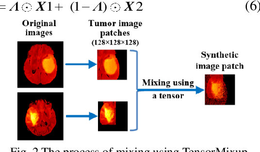 Figure 1 for A Data Augmentation Method for Fully Automatic Brain Tumor Segmentation