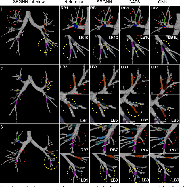Figure 3 for Structure and position-aware graph neural network for airway labeling