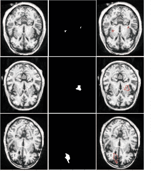 Figure 1 for D-UNet: a dimension-fusion U shape network for chronic stroke lesion segmentation