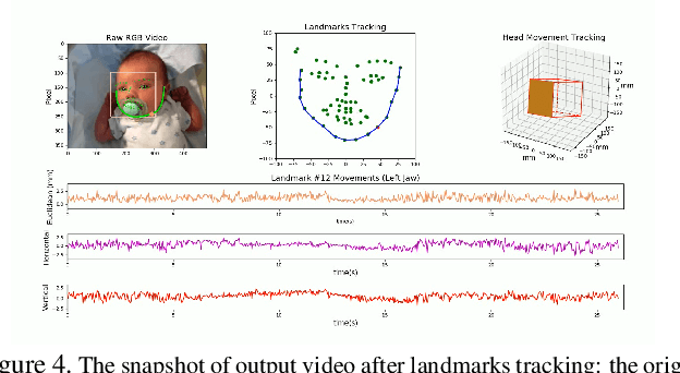 Figure 4 for Infant Contact-less Non-Nutritive Sucking Pattern Quantification via Facial Gesture Analysis