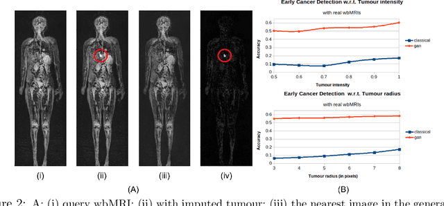 Figure 2 for Using Generative Models for Pediatric wbMRI