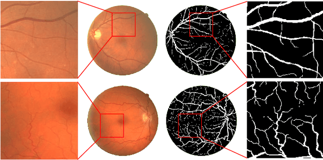 Figure 1 for SPNet: A novel deep neural network for retinal vessel segmentation based on shared decoder and pyramid-like loss