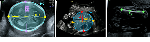 Figure 1 for AutoFB: Automating Fetal Biometry Estimation from Standard Ultrasound Planes