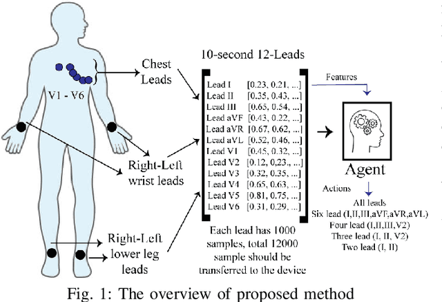 Figure 1 for Neural Contextual Bandits Based Dynamic Sensor Selection for Low-Power Body-Area Networks