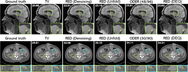 Figure 4 for Online Deep Equilibrium Learning for Regularization by Denoising