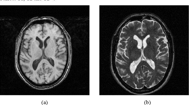Figure 1 for Binary and nonbinary description of hypointensity in human brain MR images
