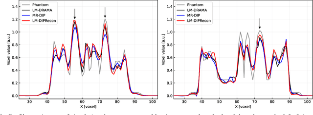 Figure 3 for List-Mode PET Image Reconstruction Using Deep Image Prior