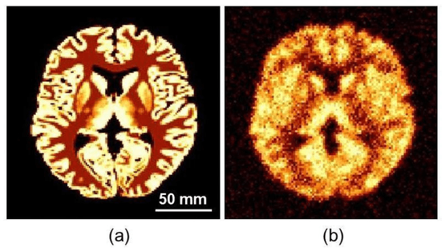 Figure 1 for Alternating direction method of multipliers applied to medical image restoration