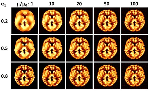 Figure 3 for Alternating direction method of multipliers applied to medical image restoration
