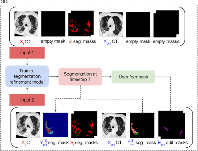 Figure 4 for Interactive Segmentation for COVID-19 Infection Quantification on Longitudinal CT scans