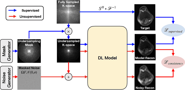 Figure 1 for Noise2Recon: A Semi-Supervised Framework for Joint MRI Reconstruction and Denoising