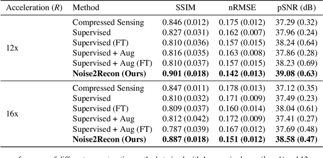 Figure 2 for Noise2Recon: A Semi-Supervised Framework for Joint MRI Reconstruction and Denoising