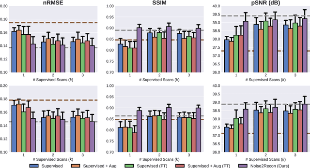 Figure 3 for Noise2Recon: A Semi-Supervised Framework for Joint MRI Reconstruction and Denoising