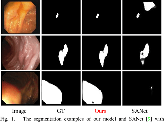 Figure 1 for Polyp-PVT: Polyp Segmentation with Pyramid Vision Transformers