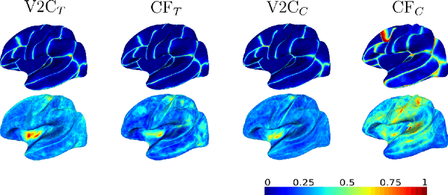 Figure 3 for Joint Reconstruction and Parcellation of Cortical Surfaces