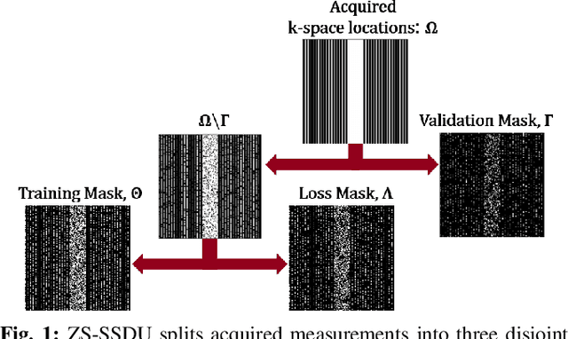 Figure 1 for Scan-Specific MRI Reconstruction using Zero-Shot Physics-Guided Deep Learning