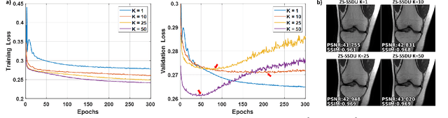 Figure 2 for Scan-Specific MRI Reconstruction using Zero-Shot Physics-Guided Deep Learning