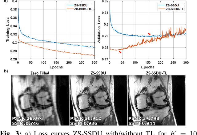 Figure 3 for Scan-Specific MRI Reconstruction using Zero-Shot Physics-Guided Deep Learning