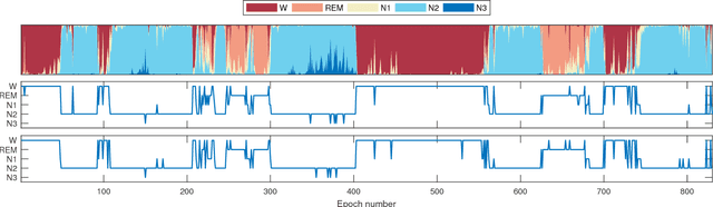 Figure 2 for Deep residual networks for automatic sleep stage classification of raw polysomnographic waveforms