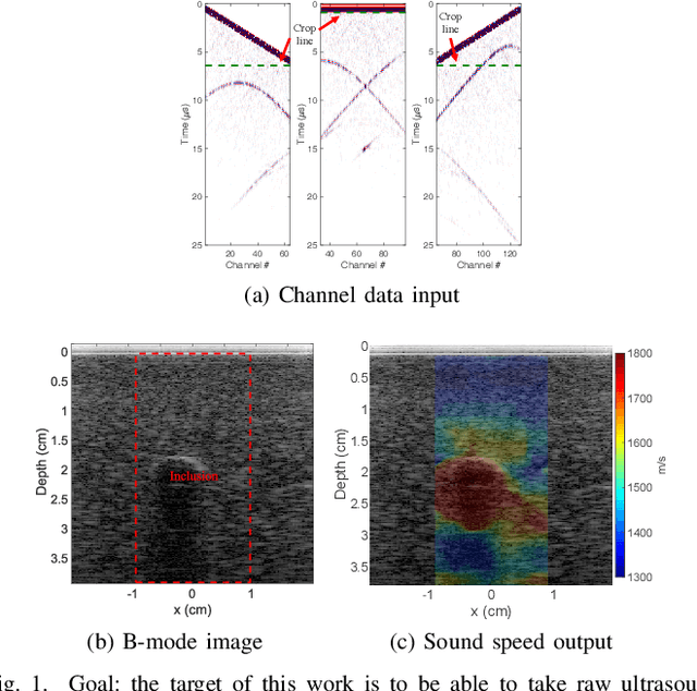 Figure 1 for A Deep Learning Framework for Single-Sided Sound Speed Inversion in Medical Ultrasound