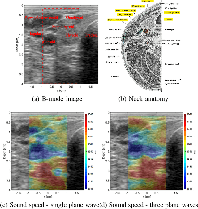 Figure 2 for A Deep Learning Framework for Single-Sided Sound Speed Inversion in Medical Ultrasound