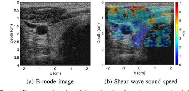 Figure 3 for A Deep Learning Framework for Single-Sided Sound Speed Inversion in Medical Ultrasound