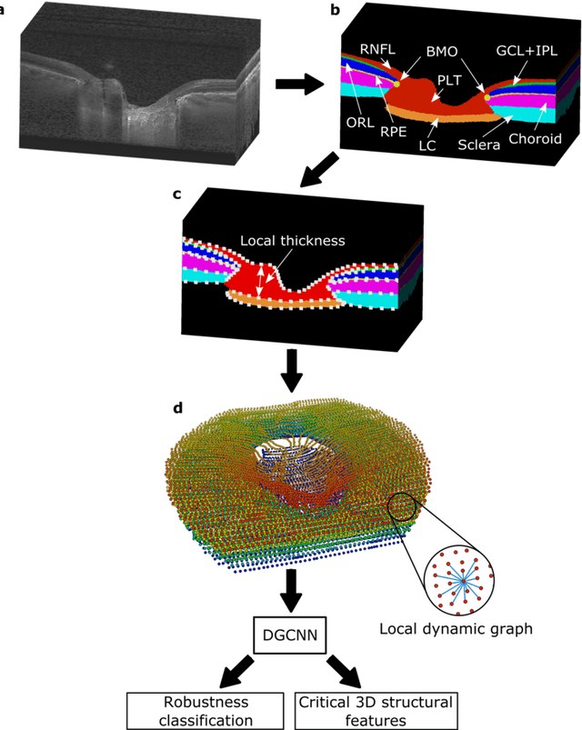 Figure 4 for AI-based Clinical Assessment of Optic Nerve Head Robustness Superseding Biomechanical Testing