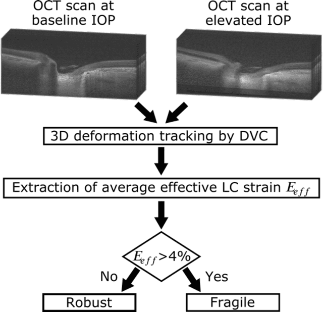 Figure 2 for AI-based Clinical Assessment of Optic Nerve Head Robustness Superseding Biomechanical Testing