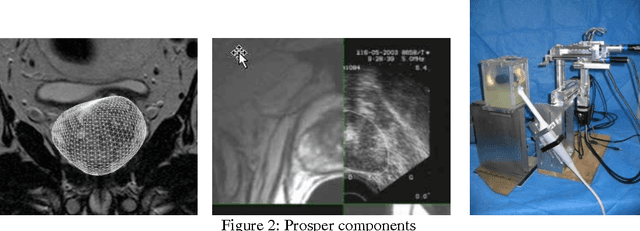 Figure 2 for Prosper: image and robot-guided prostate brachytherapy