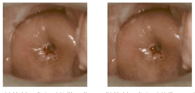 Figure 1 for Improving the repeatability of deep learning models with Monte Carlo dropout