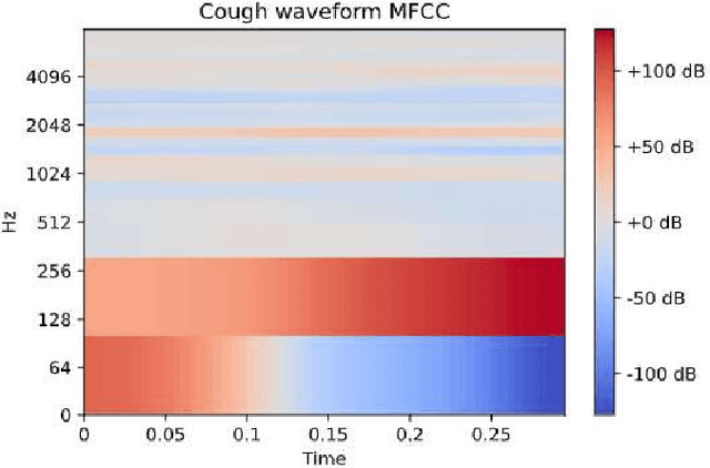Figure 2 for Cough Detection from Acoustic signals for patient monitoring system
