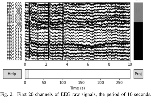 Figure 2 for A case study on profiling of an EEG-based brain decoding interface on Cloud and Edge servers